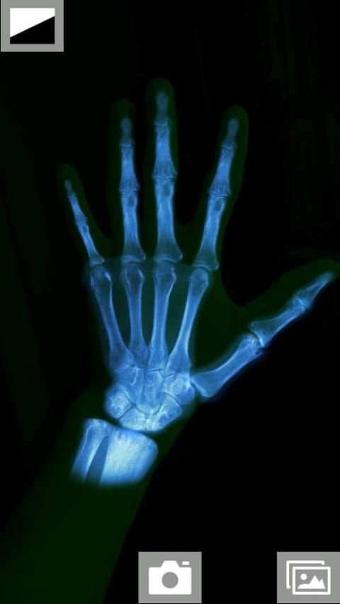 Super XRay Camera स्क्रीनशॉट 3