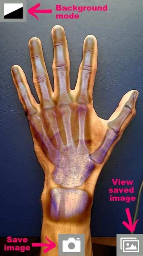 Super XRay Camera स्क्रीनशॉट 4