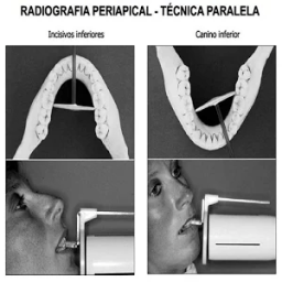 Radiografia Dental icon