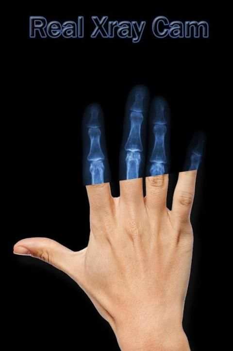 Xray Cam Real screenshot 3