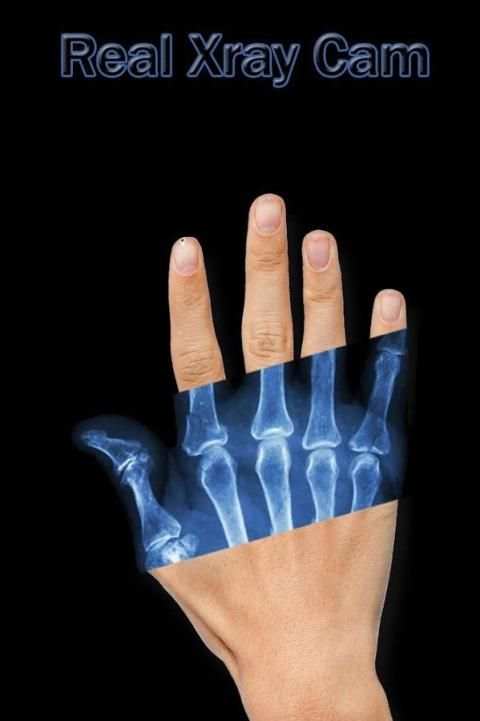 Xray Cam Real screenshot 4