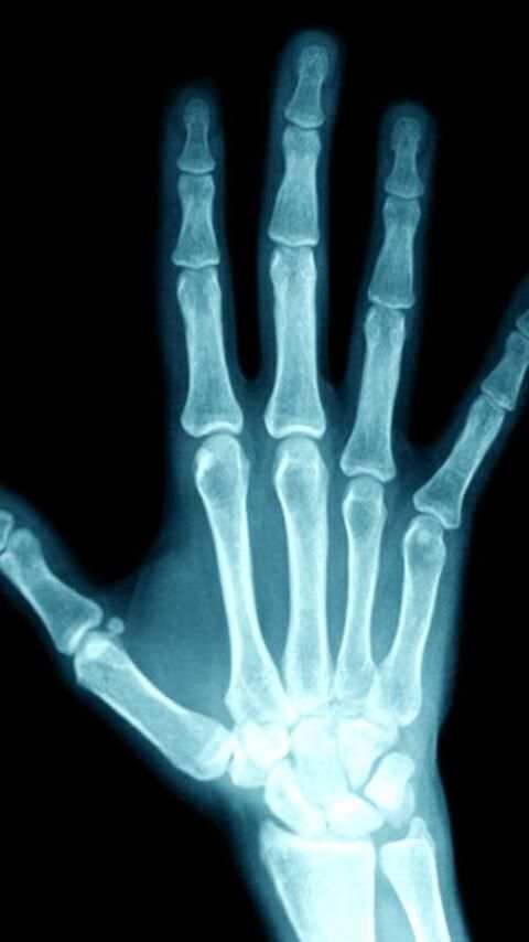 X-Ray Scanner скриншот 2
