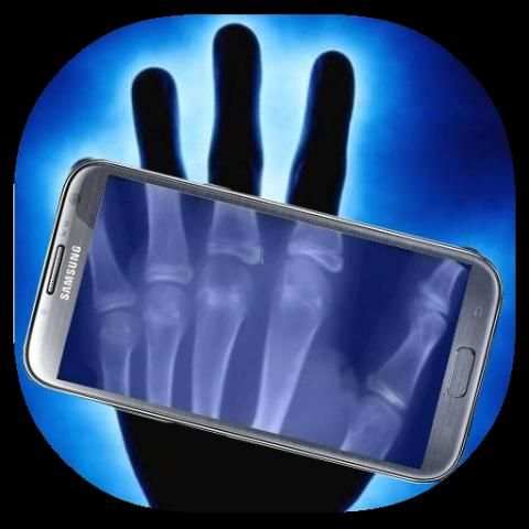 X- ray Scanner Funny screenshot 1