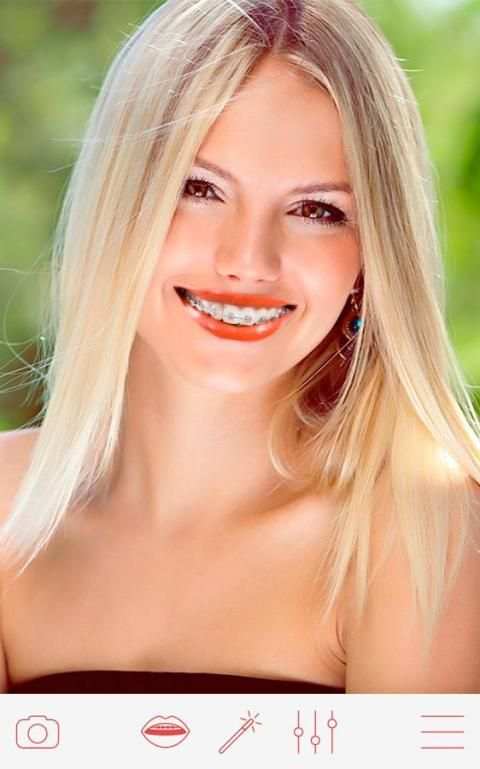 Braces 4 تصوير الشاشة