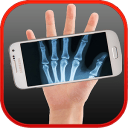 ikon X-ray Bones simulated