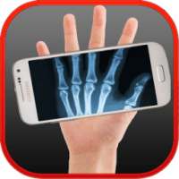 X-ray Bones simulated