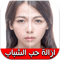 طرق إزالة حب الشباب "بدون نت" icon