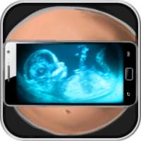 Scanner Pregnant X-Ray