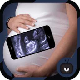 Scanner Pregnant Xray Prank