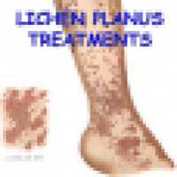 Lichen Planus Treatments