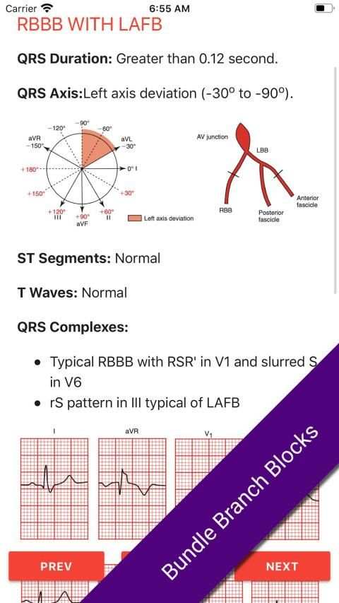 ECG FlashCards 2 Lite - Free Reference EKG App screenshot 9