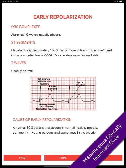 ECG FlashCards 2 Lite - Free Reference EKG App screenshot 1