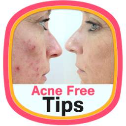 Acne Free Tips