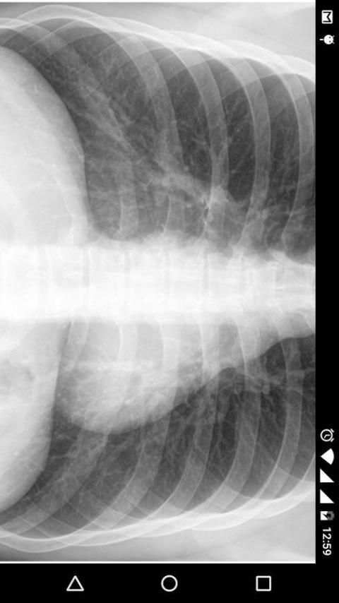X - Ray Scanner Prank скриншот 3