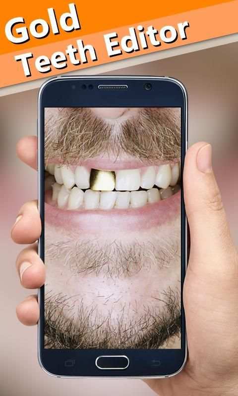 Gold Teeth Photo Editor screenshot 3