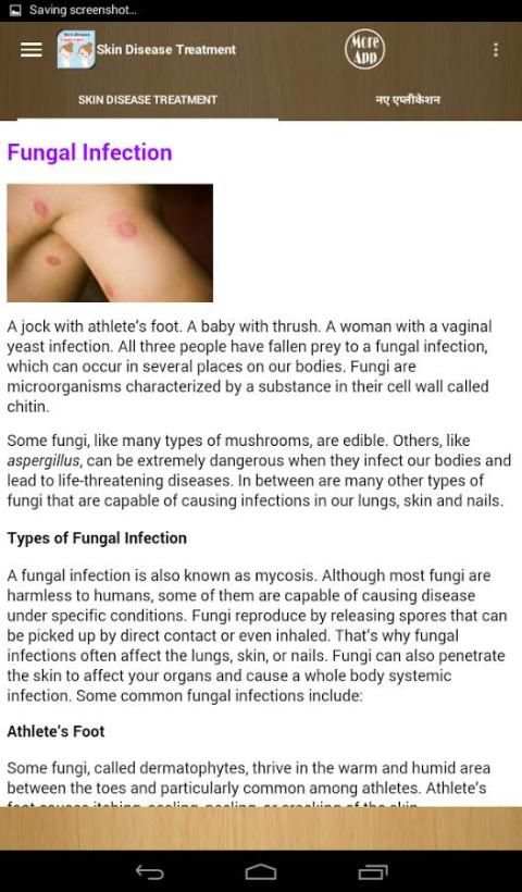 Skin Disease And Treatment скриншот 1
