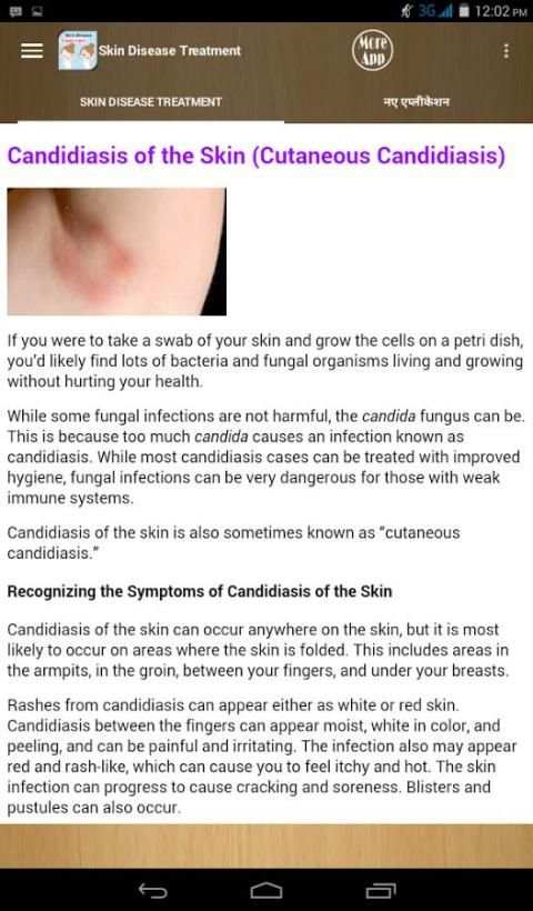Skin Disease And Treatment скриншот 2