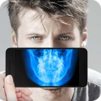 Real XRay Body Scanner Joke