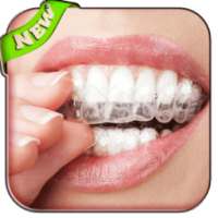 teeth whitening secrets tips