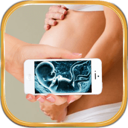 ikon Ultrasound Scanner Prank