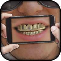 Gold Teeth Photo Editor