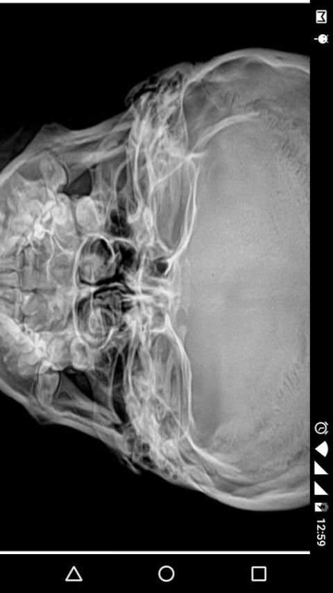X - Ray Scanner Prank screenshot 4