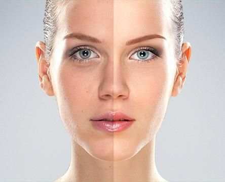 Acne Remover Photo Editor screenshot 1