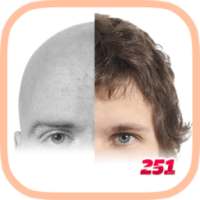 Hair Restorer - Anti hair loss on 9Apps