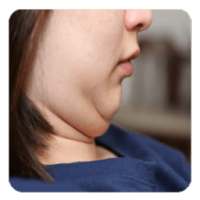 Double chin on 9Apps