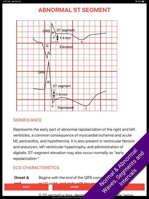 ECG FlashCards 2 Lite - Free Reference EKG App screenshot 6