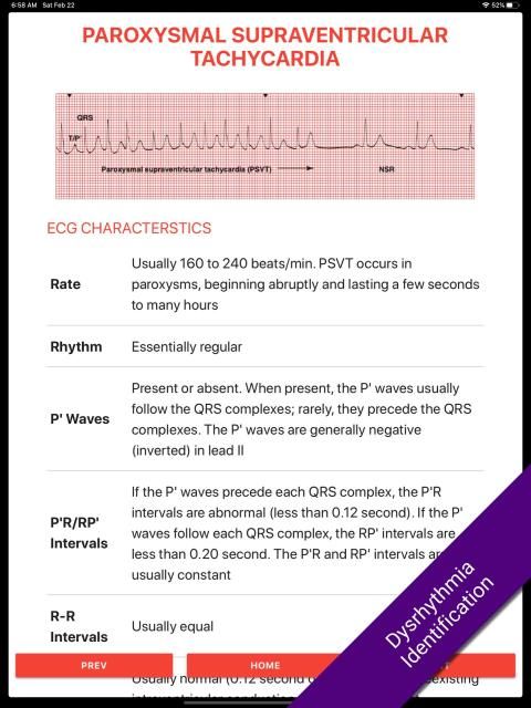ECG FlashCards 2 Lite - Free Reference EKG App स्क्रीनशॉट 5