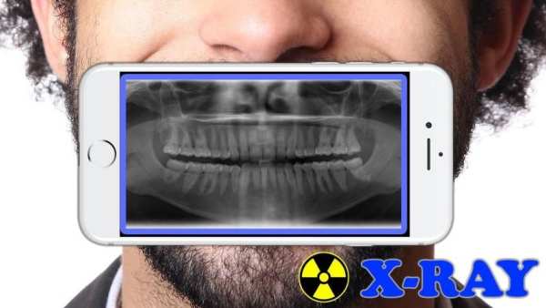 X-Ray Filter Photo screenshot 2