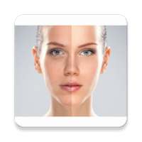 Acne Remover Photo Editor