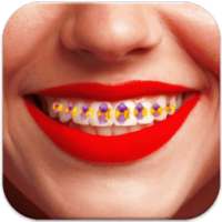 Braces-Braces Teeth Maker on 9Apps