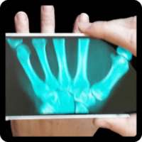 x-ray prank tangan
