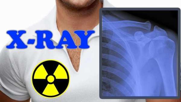 X-Ray Filter Photo screenshot 1