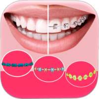 Braces Booth Selfie Camera on 9Apps