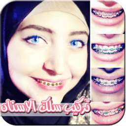 تركيب سلك الاسنان على الصور icon