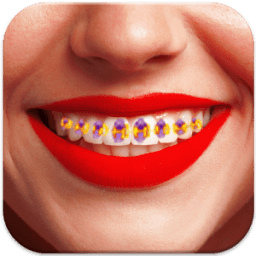 Braces-Braces Teeth Maker आइकन
