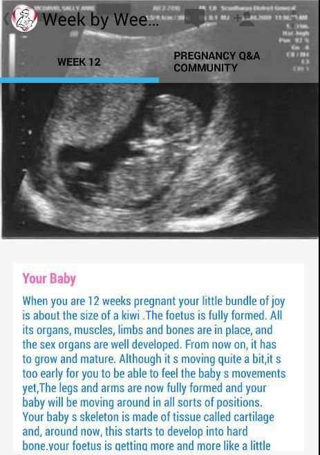 Pregnancy Stages 7 تصوير الشاشة