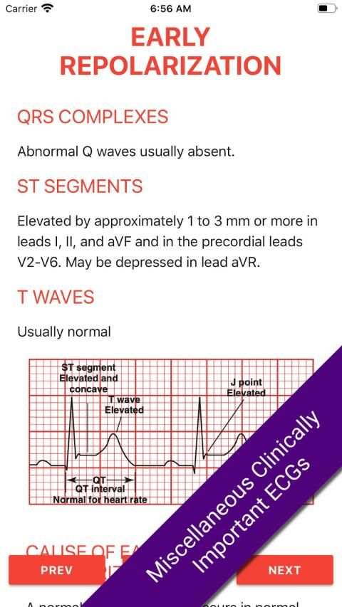 ECG FlashCards 2 Lite - Free Reference EKG App screenshot 7