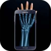 Xray Cam Real