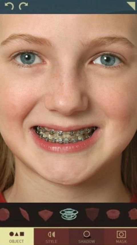 Braces-Braces Teeth Maker screenshot 4