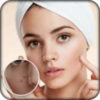 Pimple Remover : Beauty Plus