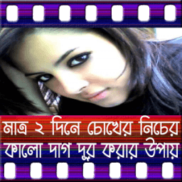 চোখের কালো দাগ দূর করার উপায় icon