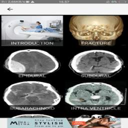 HEAD TRAUMA CT EVALUATION