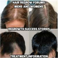 Hair loss Treatment, Forums and regrowth stories on 9Apps