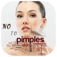 Acne/Pimples: Medical treatment