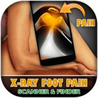 X-Ray Leg Pain Scanner Prank