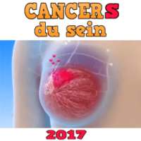 CANCERS DU SEIN : TOUTES Infos